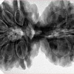 10 Mk Gaurishankar 40.1mm 9.72gm - Inverse xray