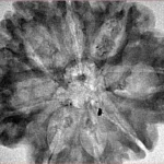 8 Mukhi Rudraksha 31.7mm 4.53gm - Inverse xray