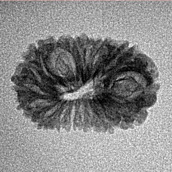 17 Mukhi Rudraksha 19.9mm 0.9gm - Inverse xray