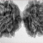 10 Mk Gaurishankar 39.6mm 8.3gm - Inverse xray