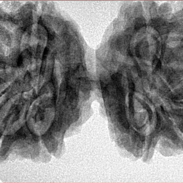 10 Mk Gaurishankar 39.6mm 8.3gm - Inverse xray