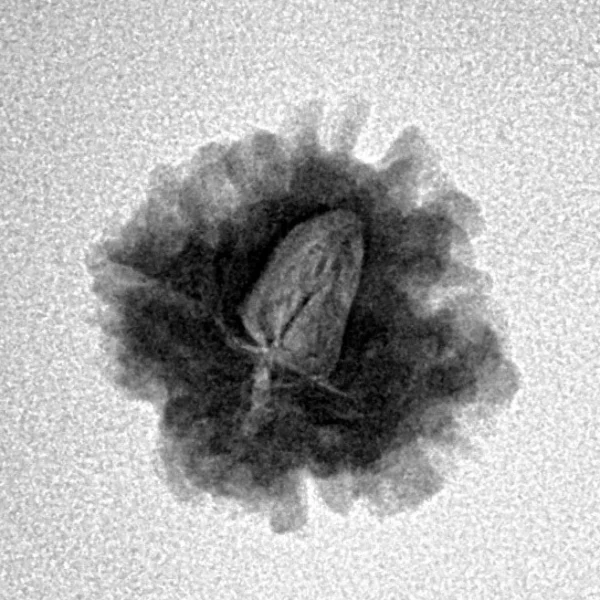 1 Mukhi Rudraksha 18.3mm 1.74gm - Inverse xray