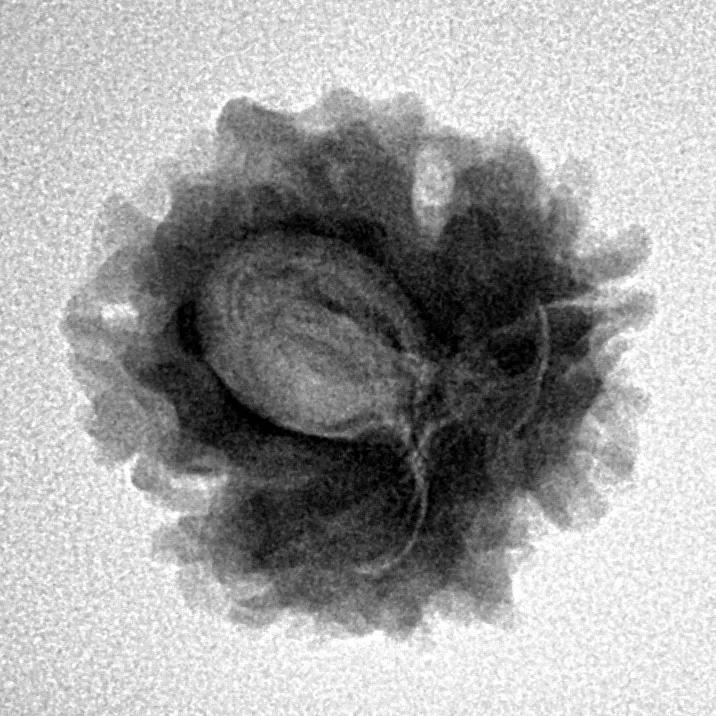 1 Mukhi Rudraksha 21.8mm 3gm - Inverse xray
