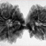 10 Mk Gaurishankar 39.4mm 8.58gm - Inverse xray