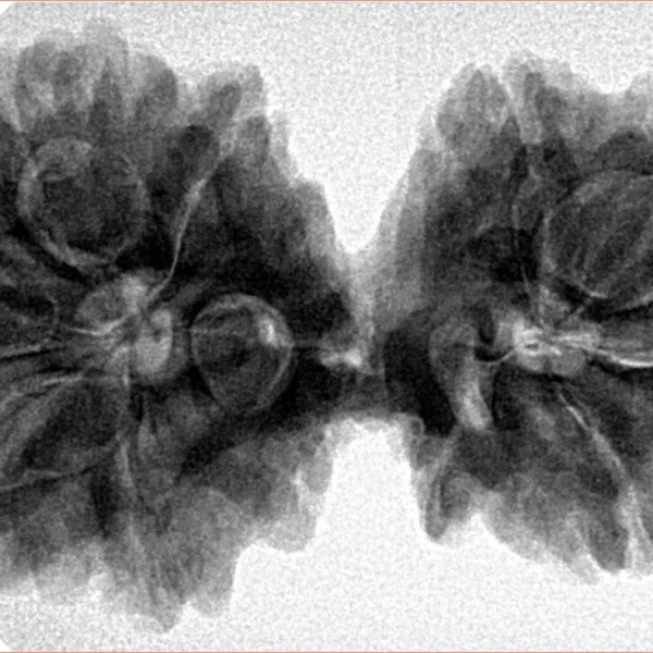 10 Mk Gaurishankar 39.4mm 8.58gm - Inverse xray