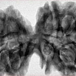 10 Mk Gaurishankar 39.8mm 8.59gm - Inverse xray