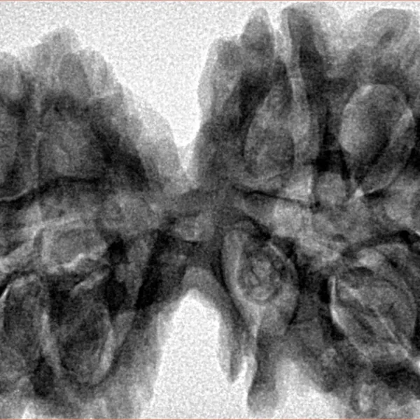 10 Mk Gaurishankar 39.8mm 8.59gm - Inverse xray