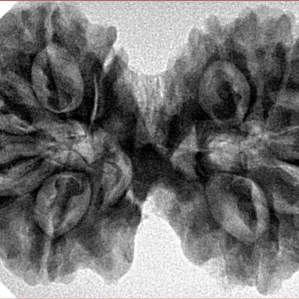 11 MK Gaurishankar 37.8mm 7.79gm - Inverse xray