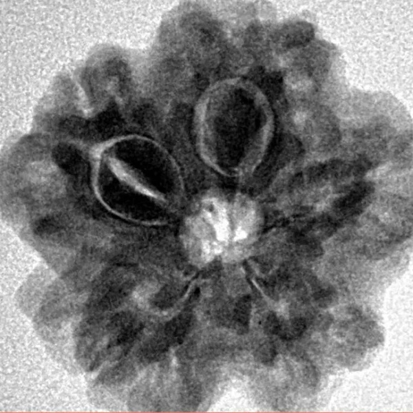 1MK(Underdeveloped) 22.3mm 3.78gm - Inverse xray
