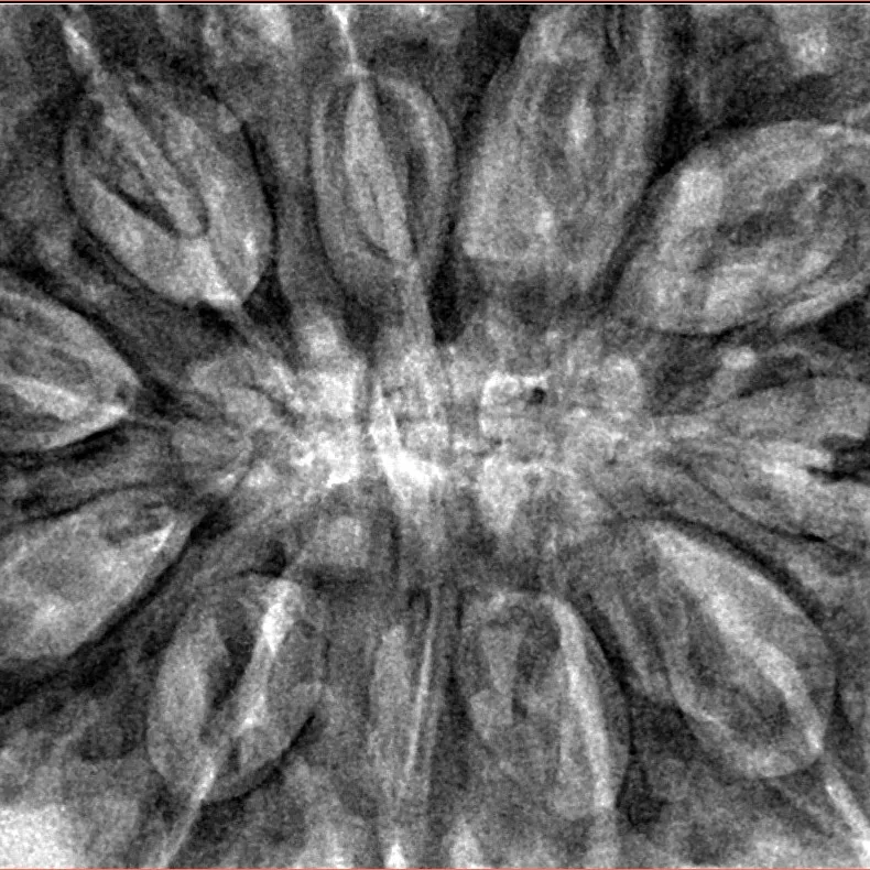 11 Mukhi Rudraksha 37.8mm 10.41gm - Inverse xray