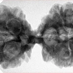 10 Mk Gaurishankar 40.1mm 8.78gm - Inverse xray