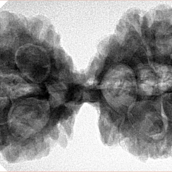 10 Mk Gaurishankar 40.1mm 8.78gm - Inverse xray