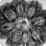 8 Mukhi Rudraksha 31.7mm 6.75gm - Inverse xray