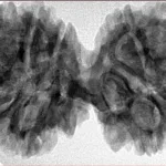11 MK Gaurishankar 41.4mm 8.17gm - Inverse xray