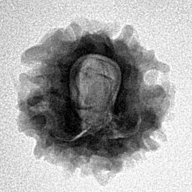 1 Mukhi Rudraksha 20.4mm 2.51gm - Inverse xray