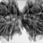 11 MK Gaurishankar 40.3mm 8.66gm - Inverse xray