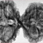 10 Mk Gaurishankar 40.7mm 9.38gm - Inverse xray