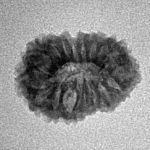 17 Mukhi Rudraksha 18.2mm 1.23gm - Inverse xray