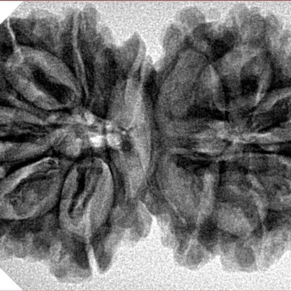 13 MK Gaurishankar 37.1mm 6.59gm - Inverse xray