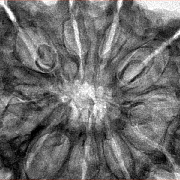 10 Mukhi Rudraksha 36mm 8.49gm - Inverse xray