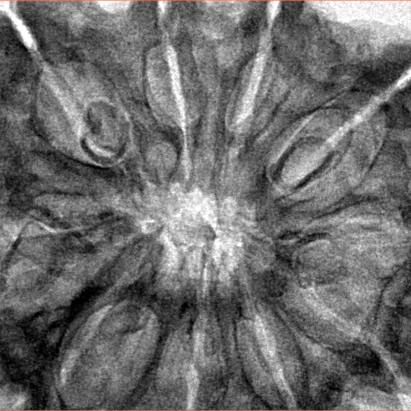 10 Mukhi Rudraksha 36mm 8.49gm - Inverse xray