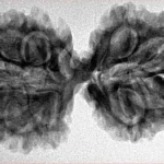 11 MK Gaurishankar 36.3mm 5.66gm - Inverse xray