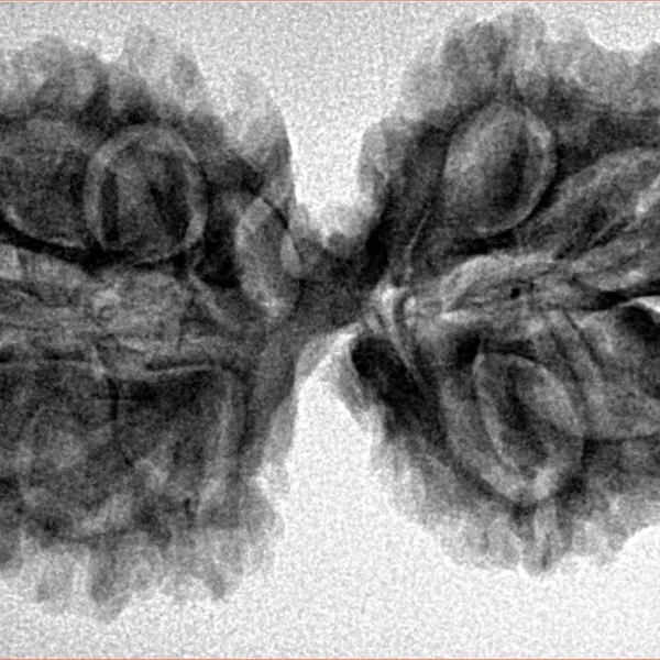 11 MK Gaurishankar 36.3mm 5.66gm - Inverse xray