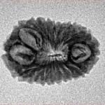 16 Mukhi Rudraksha 18.8mm 1.24gm - Inverse xray