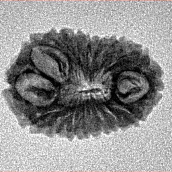 16 Mukhi Rudraksha 18.8mm 1.24gm - Inverse xray