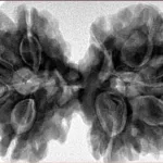 9 MK Gaurishankar 41.1mm 9.62gm - Inverse xray