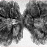 10 Mk Gaurishankar 40.6mm 9.16gm - Inverse xray