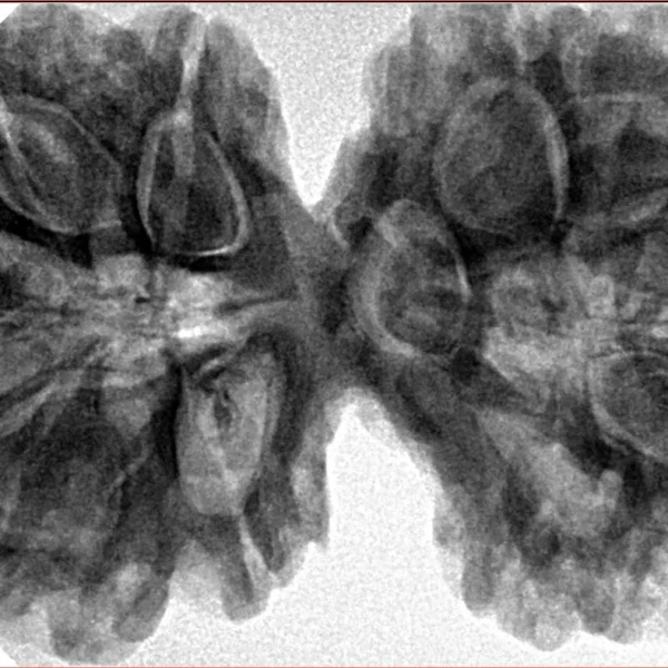 10 Mk Gaurishankar 40.6mm 9.16gm - Inverse xray
