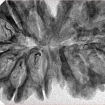 13 MK Gaurishankar 40.3mm 5.86gm - Inverse xray