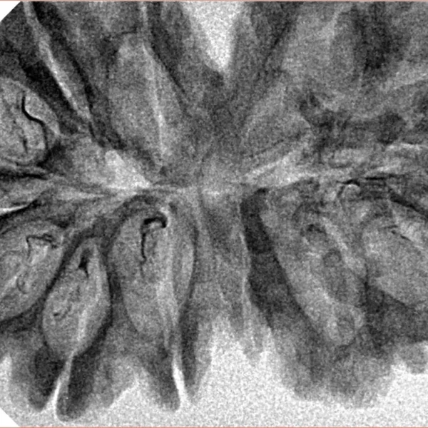 13 MK Gaurishankar 40.3mm 5.86gm - Inverse xray