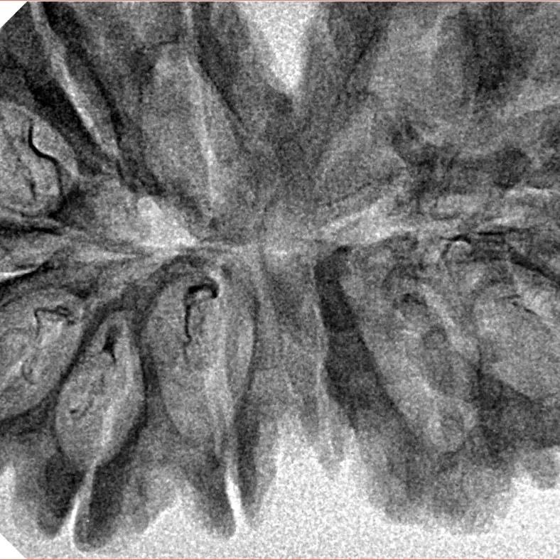 13 MK Gaurishankar 40.3mm 5.86gm - Inverse xray