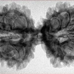 13 MK Gaurishankar 39.2mm 6.5gm - Inverse xray
