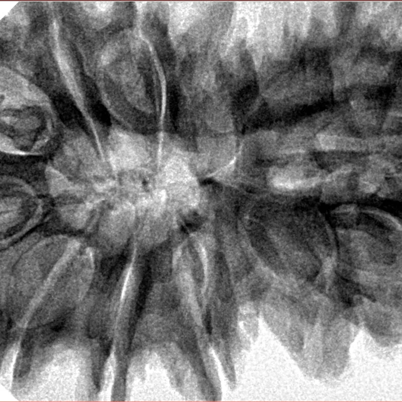 13 MK Gaurishankar 41mm 9.99gm - Inverse xray