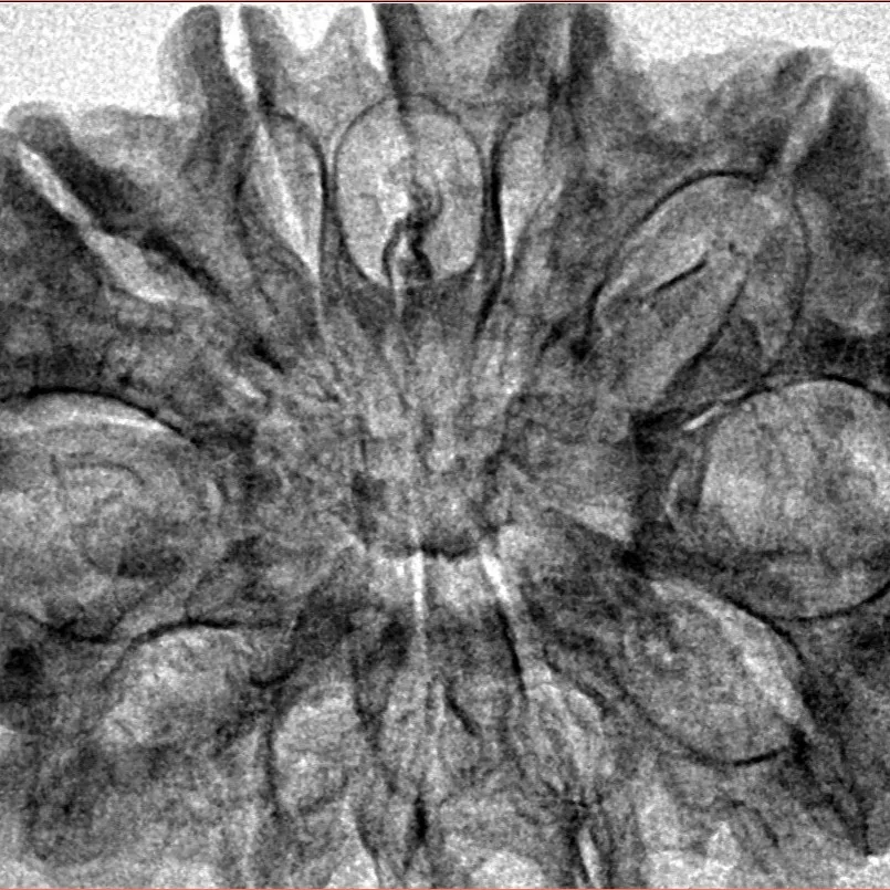 12 Mukhi Rudraksha 35mm 5.49gm - Inverse xray