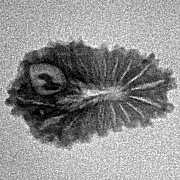 17 Mukhi Rudraksha 18.9mm 0.93gm - Inverse xray
