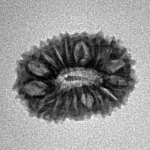 17 Mukhi Rudraksha 18mm 1.42gm - Inverse xray