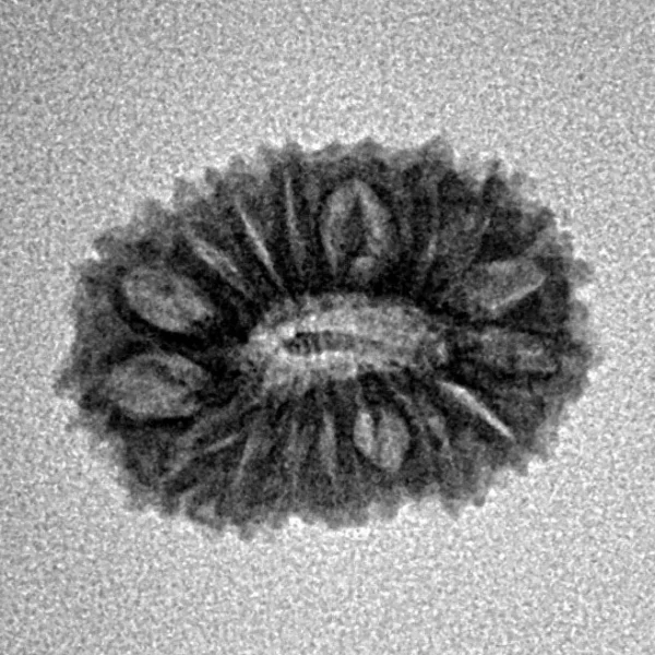 17 Mukhi Rudraksha 18mm 1.42gm - Inverse xray