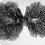 10 Mk Gaurishankar 37.8mm 8.35gm - Inverse xray