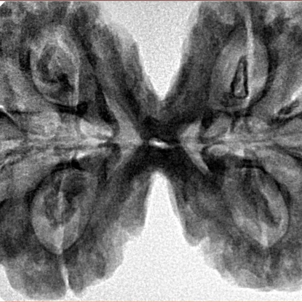 8 MK Gaurishankar 41.1mm 10.62gm - Inverse xray