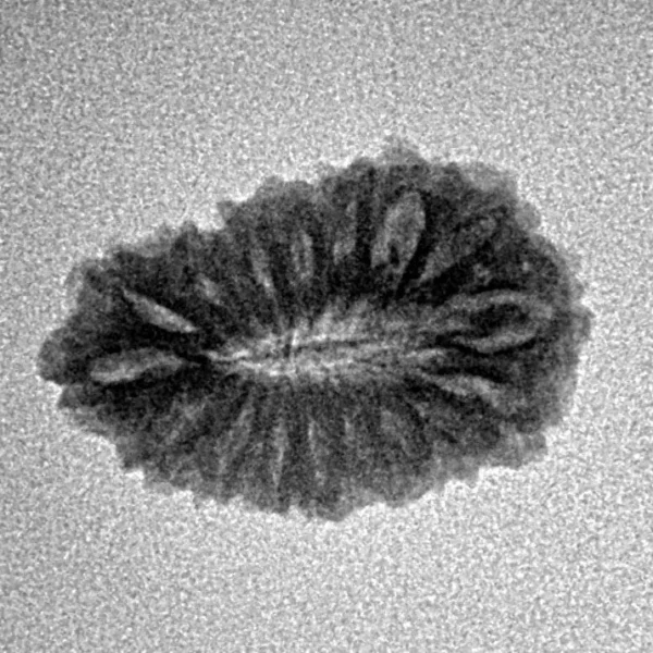 17 Mukhi Rudraksha 19.7mm 1.41gm - Inverse xray