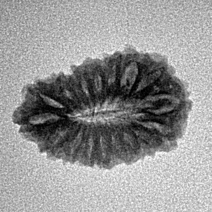 17 Mukhi Rudraksha 19.7mm 1.41gm - Inverse xray