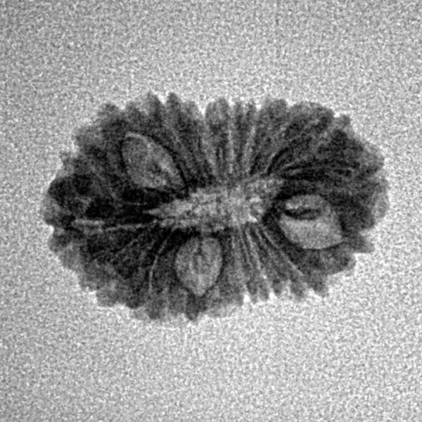 17 Mukhi Rudraksha 19.3mm 1.23gm - Origin: Indonesia - Inverse xray