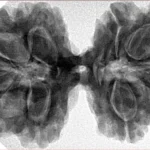 10 Mk Gaurishankar 38.3mm 9.09gm - Inverse xray