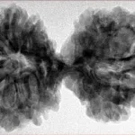 10 Mk Gaurishankar 39.9mm 7.32gm - Inverse xray