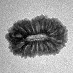 17 Mukhi Rudraksha 18.5mm 1.48gm - Inverse xray