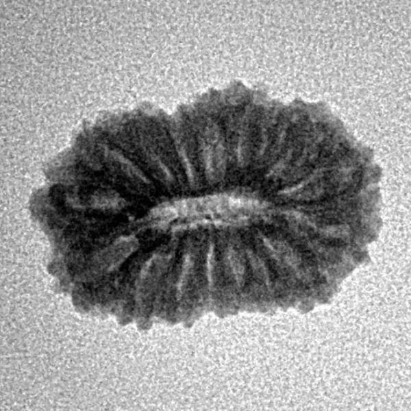 17 Mukhi Rudraksha 18.5mm 1.48gm - Inverse xray